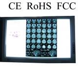 three panel LED x-ray film viewer negatoscope medical devices