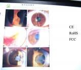 one bank x-ray illuminator LED medical supply